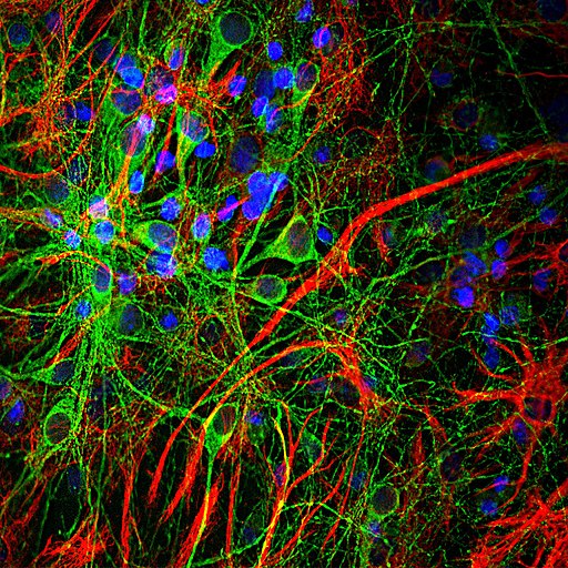 image of neurons with tau protein stained