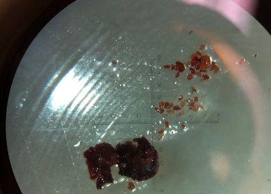 Petri skål, med små frå fra at blåbær.