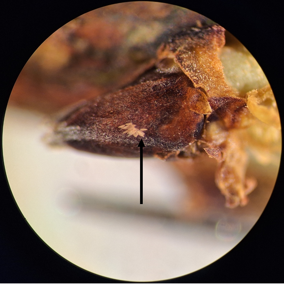 insektegg i mikroskop