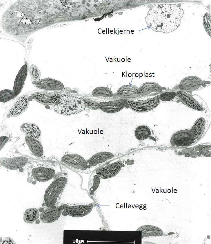 TEM bilde celle fra blad