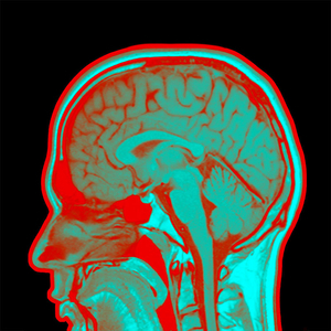 scan av et hode